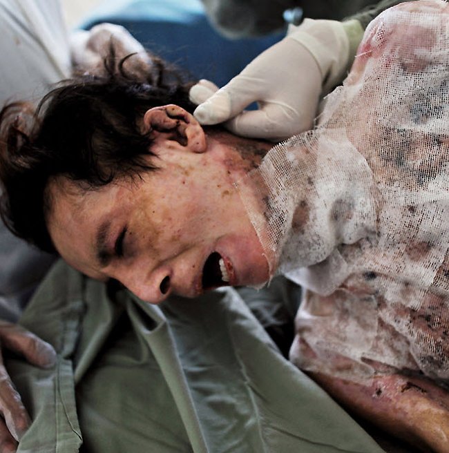 Самосожжение женщин в афганском городе Герат