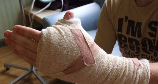 Врачи пересадили англичанину большой палец с ноги на руку (4 фото+видео)