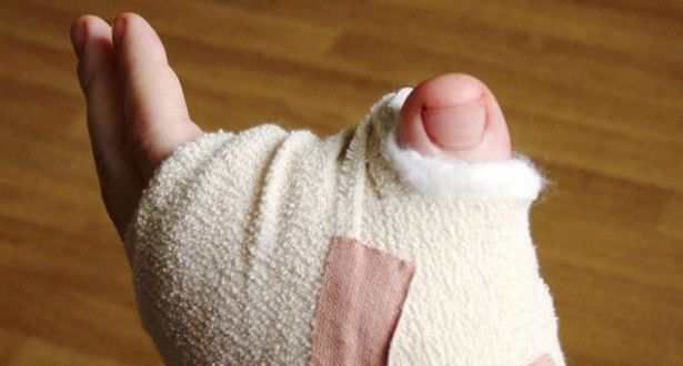 Врачи пересадили англичанину большой палец с ноги на руку (4 фото+видео)