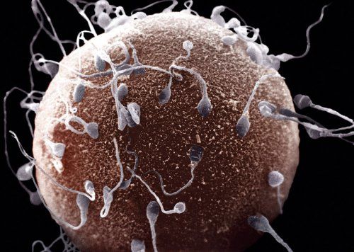 10 фактов о сперме человека (10 фото)