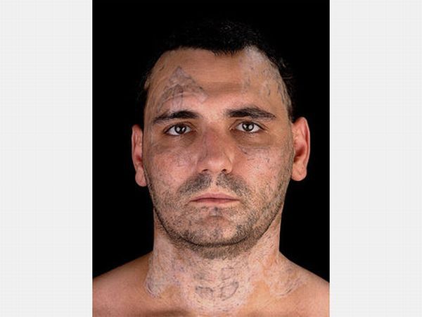 Удаление татуировок с лица скинхеда (12 фото)