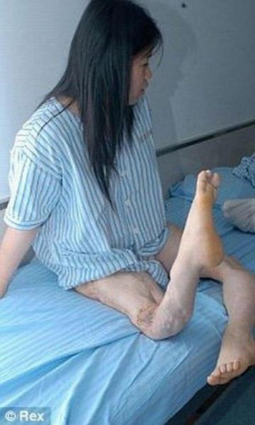 Девушка со странными ногами (4 фото)