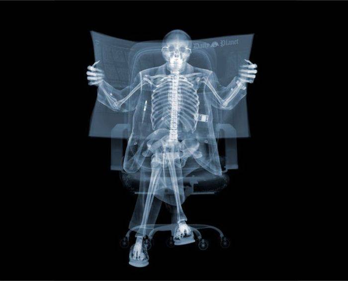 Разные предметы в рентгеновских лучах (54 фото)