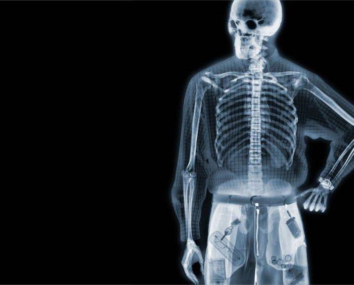 Разные предметы в рентгеновских лучах (54 фото)