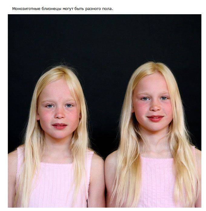 Интересные факты о близнецах (21 фото)