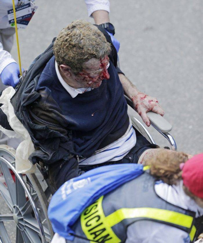 Теракт в Бостоне: два взрыва на финише марафона (18 фото)