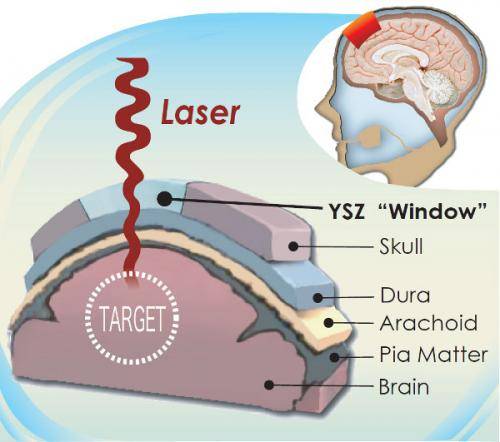 Новый прозрачный черепной имплантат буквально создаёт «окно в мозг»
