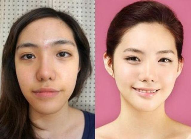 До и после пластической операции (60 фото)