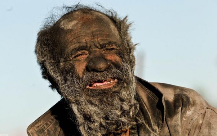 Как выглядит человек, который не мылся 60 лет ... (7 фото)