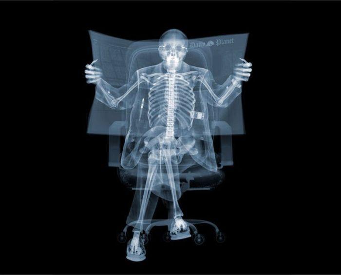 Разные предметы в рентгеновских лучах (56 фото)