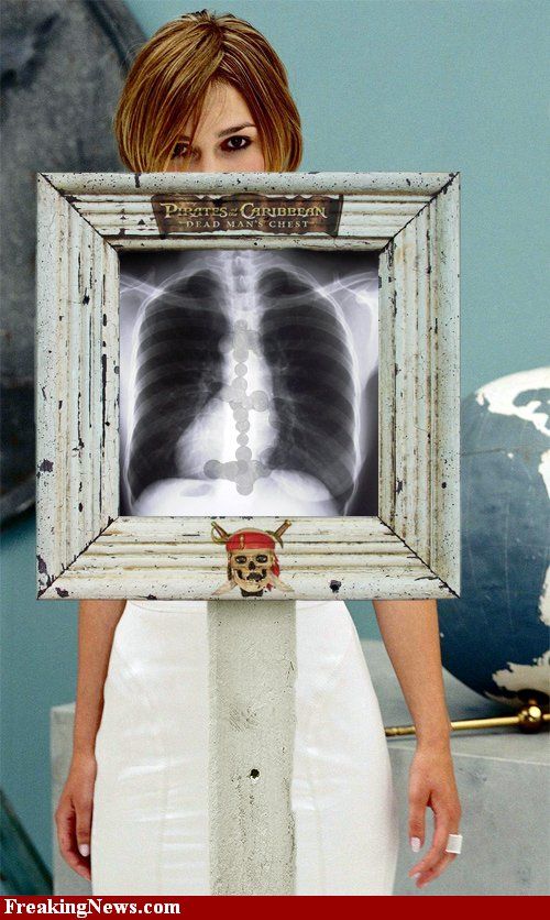Знаменитости под рентгеновскими лучами (29 фото) 