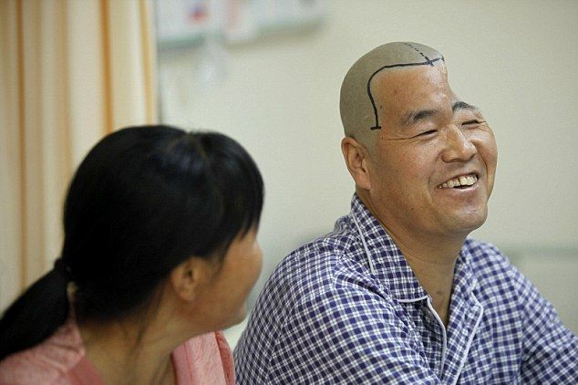 Врачи распечатали китайскому фермеру новый череп (5 фото)