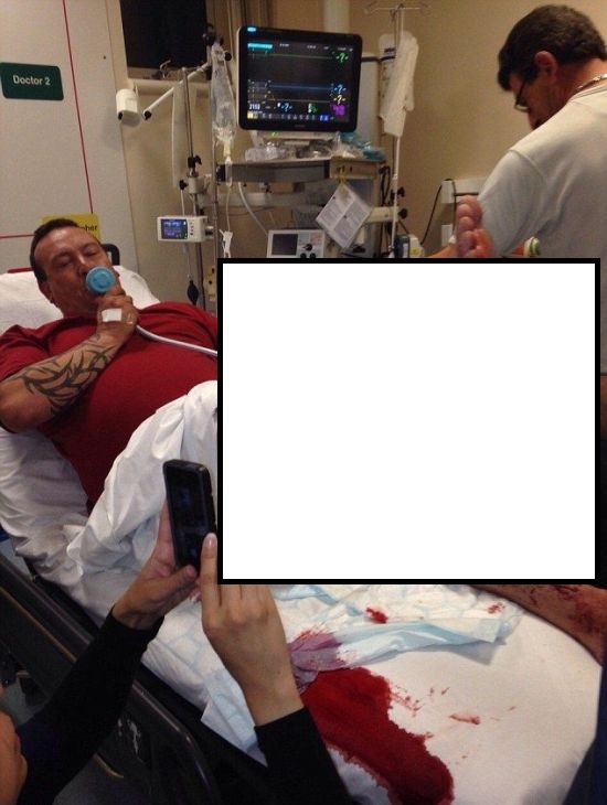 Электронная сигарета прострелила парню ногу (4 фото)
