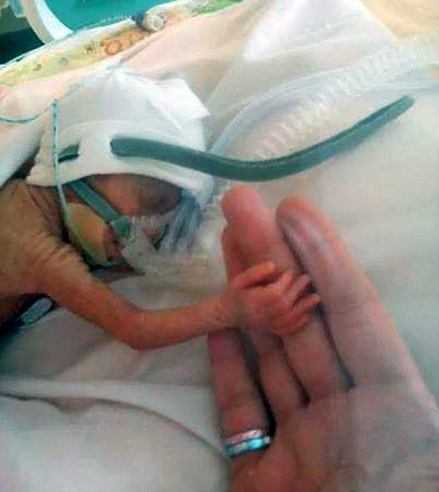  24-недельная малышка выжила! (7 фото) 