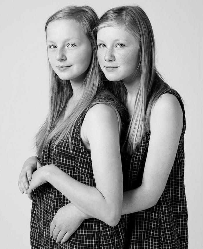 НЕ кровные братья и сестры-близнецы (22 фото)