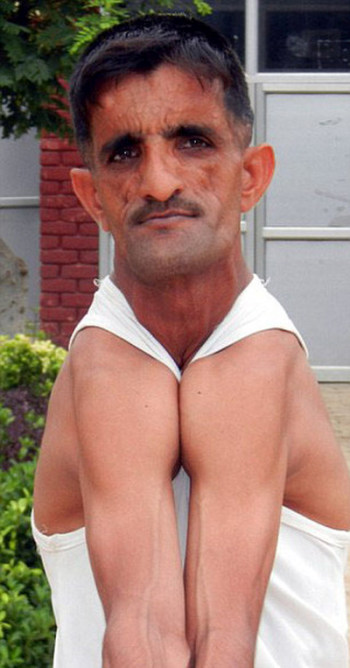 «резиновый человек» из Индии, побил собственный рекорд (6 фото)