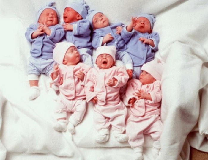  Первым в мире близнецам-семерняшкам исполнилось 18 лет (7 фото)