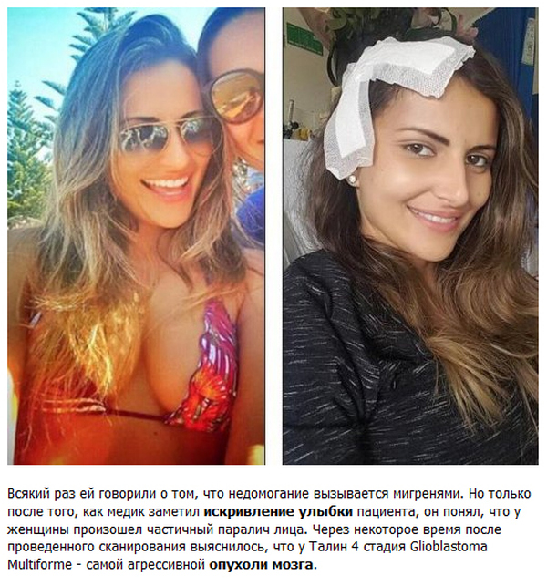  Как улыбка спасла жизнь 30-летней бразильянке (4 фото)