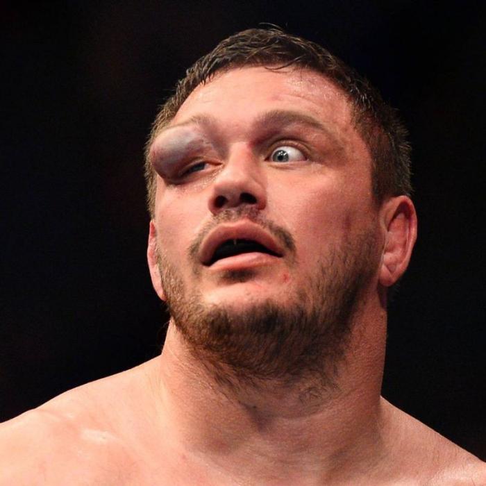 Самая отвратительная травма глаза в истории MMA (9 фото)