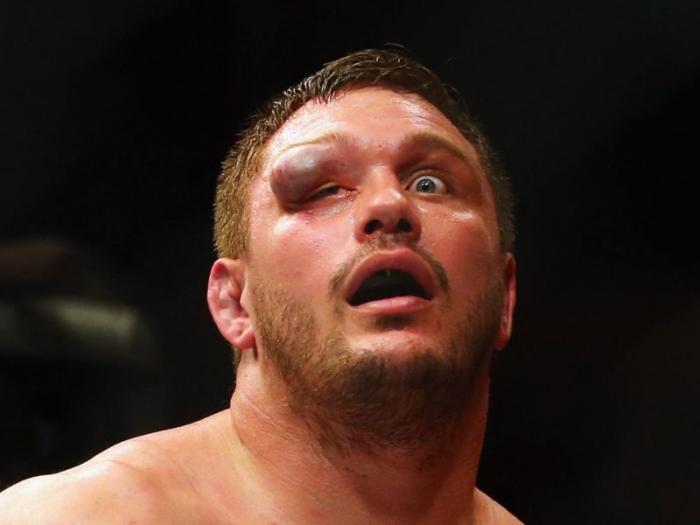 Самая отвратительная травма глаза в истории MMA (9 фото)