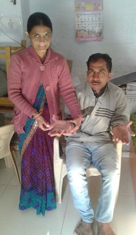 Девендра Сутхар - рекордсмен мира по количеству пальцев (7 фото)