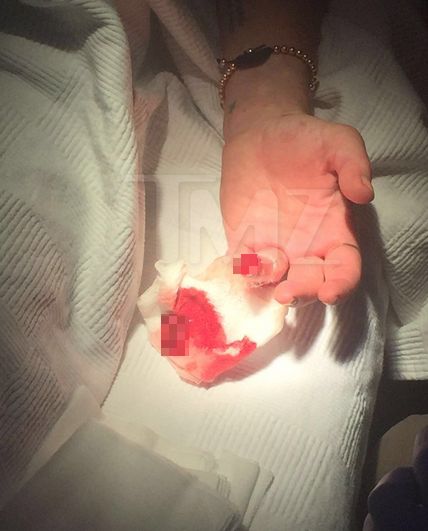 Линдси Лохан лишалась части безымянного пальца левой руки (2 фото)