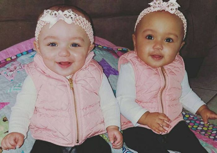 Сестры-близнецы с разным цветом кожи (5 фото)
