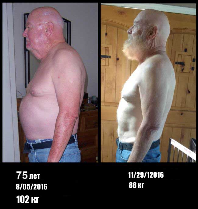 Пожилой мужчина сел на диету (2 фото)