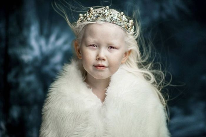 8-летняя девочка-альбинос Нарияна, зовут «Снежной королевой» (7 фото)