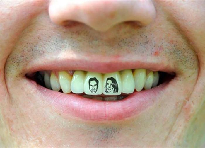 Набирает популярность новый тренд: тату на зубах  (11 фото)