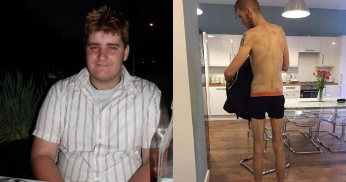 История тучного мужчины, потерявшего половину своего веса (10 фото)