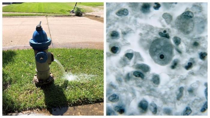 В техасском водопроводе обнаружили амебу, пожирающую мозг (5 фото) 