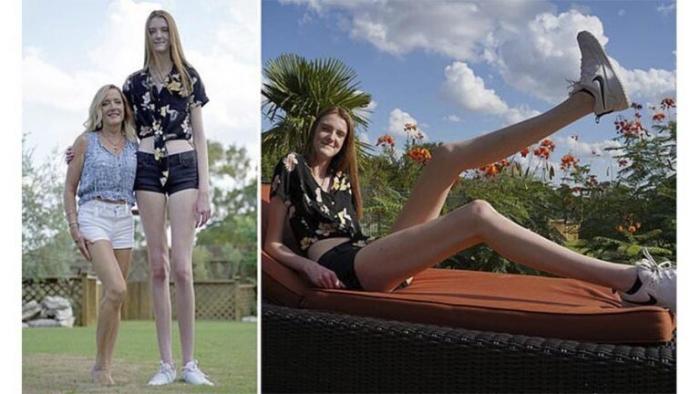 Мэйси Каррин обладательница самых длинных ног в мире (5 фото) 