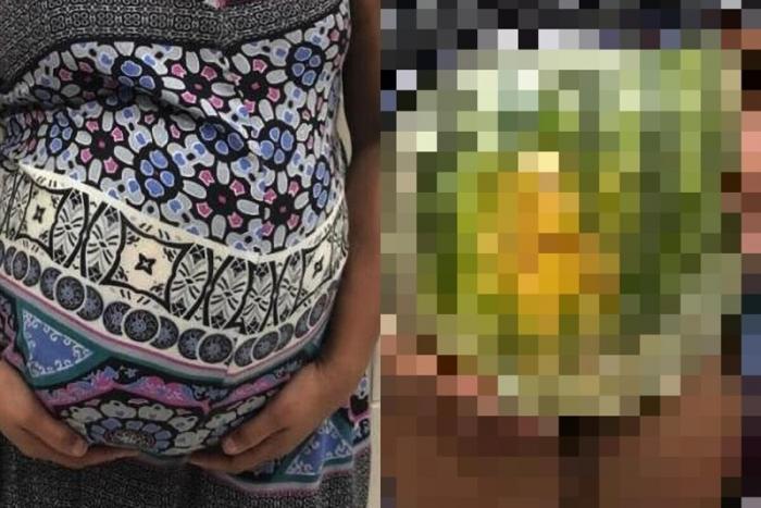 Полицейские Сан-Паулу задержали беременную с начинкой в животе(3 фото)