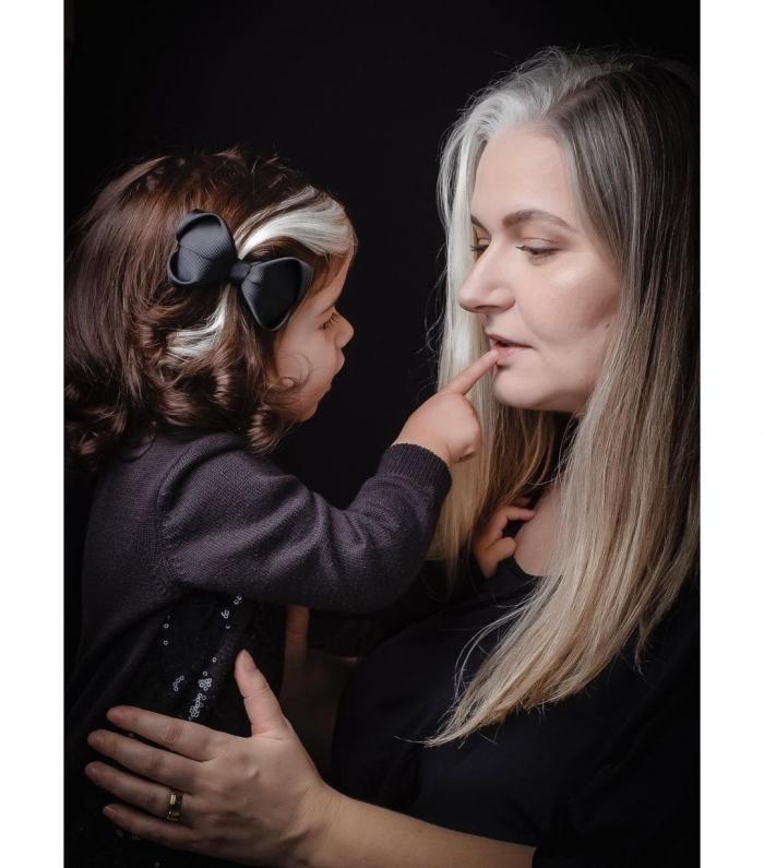 Бразильянка учит маленькую дочку не стесняться особенности (6 фото)