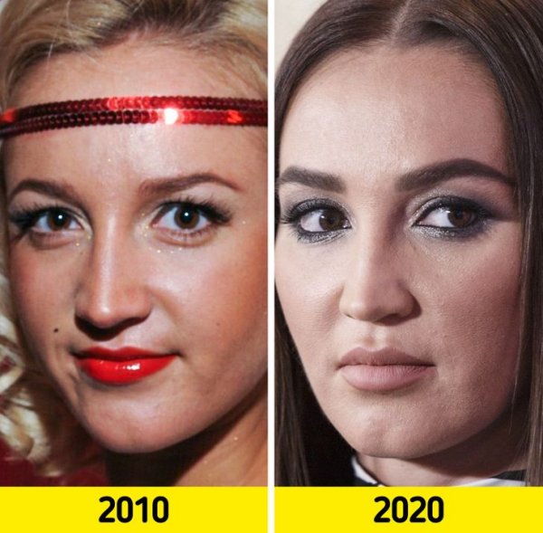 Как изменились лица отечественных знаменитостей с годами (19 фото)