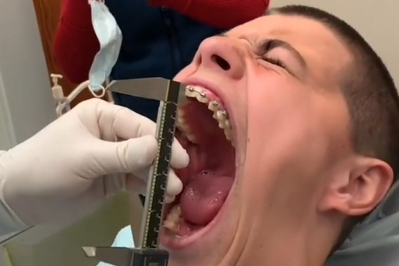 Мировой рекорд по самому широкому раскрытию рта среди мужчин (видео)