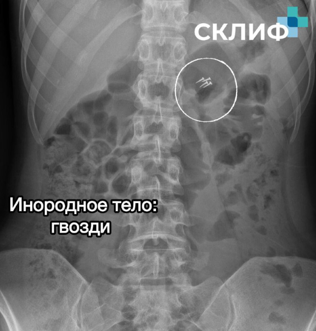 ����� ������ ���������� ���������� ���������� � �������� � ��������� (8 ����)