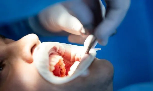 ���������� ����: ���, ��� ����� ����� ��� ��������� �������